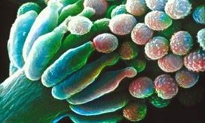 Infecções mortais de fungos resistentes a drogas ameaçam milhões                                                      “Millions at risk as deadly fungal infections acquire drug resistance”.                                                                 (Robin McKie,The Guardian,27/VIII/2016)